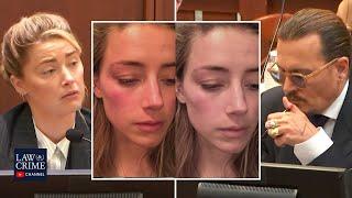 Johnny Depps Lawyer Notes Differences in Injury Photos From Amber Heard