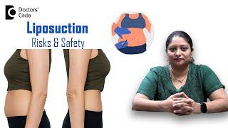 Risks Safety & Benefits of Liposuction Surgery for Weight Loss - Dr. Ramya Deepthi Doctors Circle