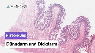 Histologie Dünndarm und Dickdarm - Mikroskopische Anatomie - AMBOSS Video