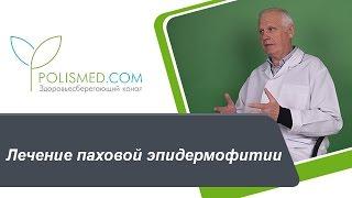 Лечение паховой эпидермофитии противогрибковые средства антимикотики. Народная медицина