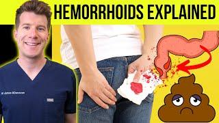 Doctor explains HEMORRHOIDS  aka piles  Causes symptoms treatment & prevention