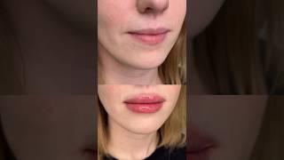 Пухлые губы ️#косметология #губы #рекомендации #красота #shortvideo #reels