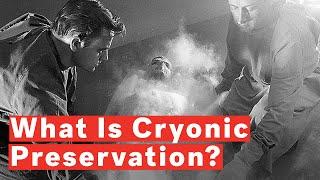 What Is Cryonic Preservation?