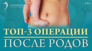 3 популярные пластические операции после родов  18+