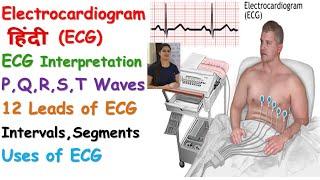 ElectrocardiogramECG in Hindi  Interpretation  12 Leads ECG  PQRST Waves  Uses of ECG