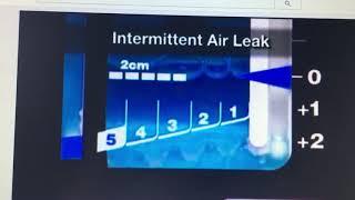 air leak chest tube education