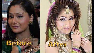 Sara Khan icredible plastic surgery  My Videos