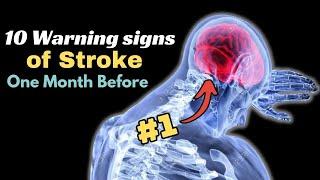 10 WARNING Signs of Stroke One Month Before DONT Ignore Them