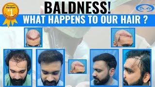 Hair Transplant in Delhi  Best Results & cost of Hair Transplant in Delhi