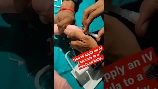 Apply cannula for New born baby  #reels #ivcannulation #viralvideo #shortsviral #medical #shorts