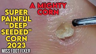 SUPER PAINFUL  DEEP SEEDED CORN 2023  A MIGHTY CORN BY MISS FOOT FIXER