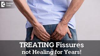 Best ways to manage Fissures that are not healing for long time - Dr. Nanda RajneeshDoctors Circle