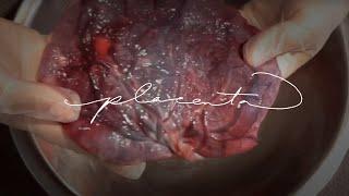 At Home Placenta Encapsulation  WARNING Graphic Content  Tahiti Rey