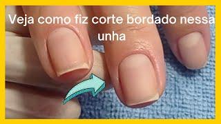 Cutícula perfeita em 5 passos - Veja como fazer o corte bordado na unha.