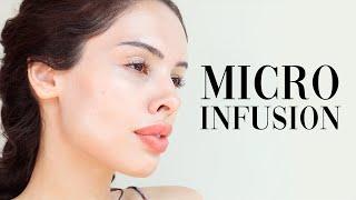 AT HOME MICRO-INFUSION FACIAL  Qure Micro-Infusion System