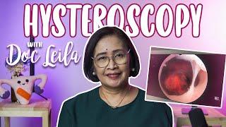 HYSTEROSCOPY - ANO ITO? With Doc Leila OB-GYN Philippines