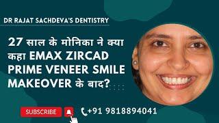 Digital Smile Design Delhi  Smile Makeover In India  Best Cosmetic Dentist Delhi  Delhi Dentist