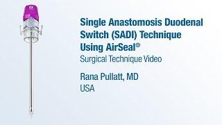 Dr. Rana Pullatt - Single Anastomosis Duodenal Switch SADI Technique Using AirSeal® - CONMED