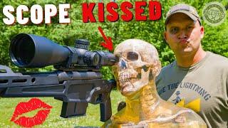 SCOPE KISSES  How Dangerous Are They ???