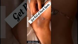 Get Rif Of Dark SpotDarkness Remove From Feet & Hand ll #skincare #tanremove #ytshorts #viralvedio