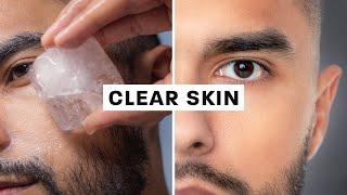 How To Get Clear Skin Science Based